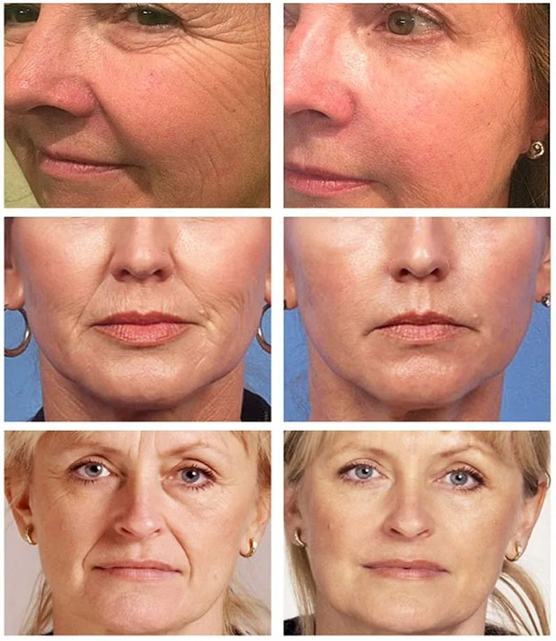 Crema de colágeno con perlas, antiedad, blanqueadora, hidratante, antisequedad, iluminadora, reafirmante y reafirmante, crema facial antiarrugas para el cuidado de la piel.