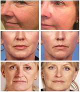 Crema de colágeno con perlas, antiedad, blanqueadora, hidratante, antisequedad, iluminadora, reafirmante y reafirmante, crema facial antiarrugas para el cuidado de la piel.