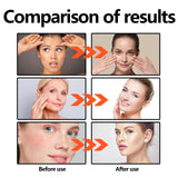 Vitamin C Face Serum 30ml Brightening, Anti Aging Tightens Minimizes Pores Hydrating Firming Essence for Fine Lines Dull Skin