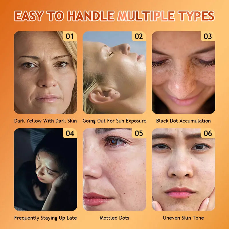 Organic Vitamin C Capsules 1000mg and Zinc 20mg Capsules Support Immune Health, anti-oxidation Beauty Health