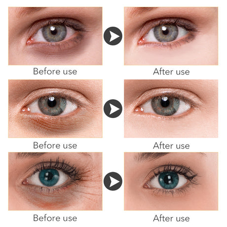 Beauty Eye Cream30mlwish Women's Skin Care Products - Lootquake