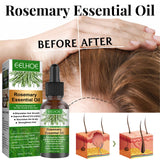 Rosemary Anti-Breakage Nourishing Hair Care Oil - Lootquake