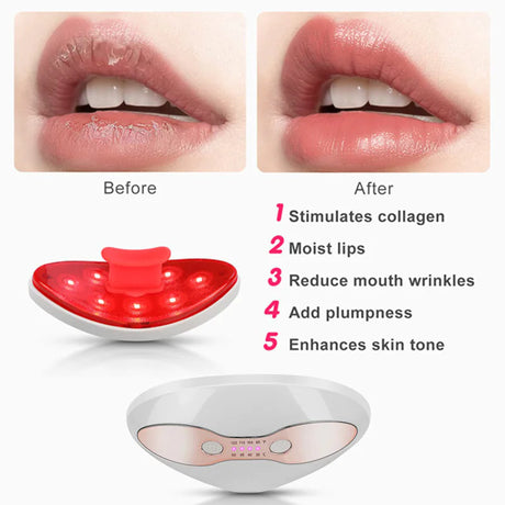 Lip Beauty Device - Lootquake