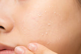 Gel exfoliante Vitapair C